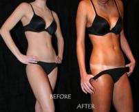Airbrush Tans in Parker Colorado